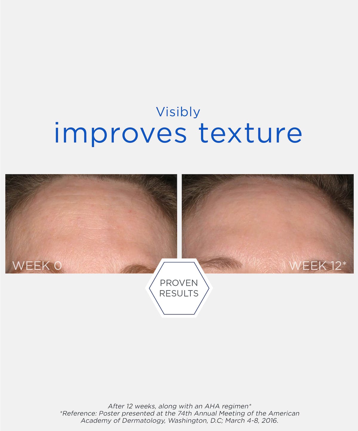 Smooth Surface Glycolic Peel Pads