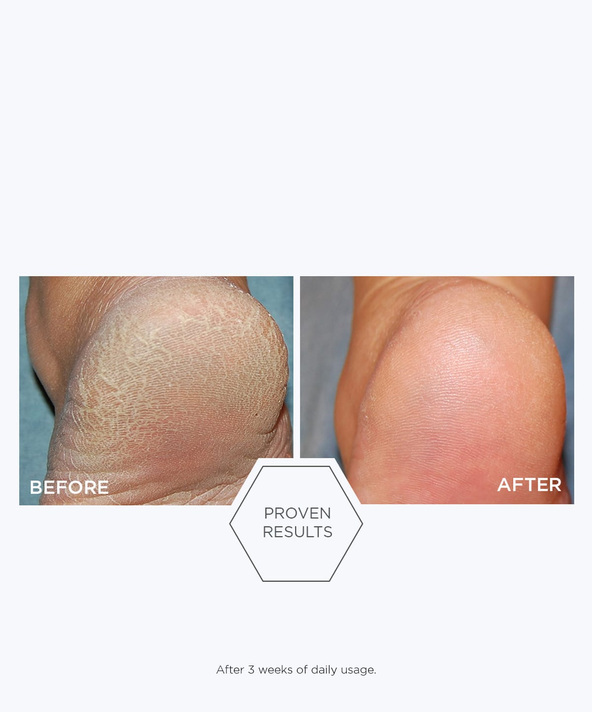 Problem Dry Skin Cream