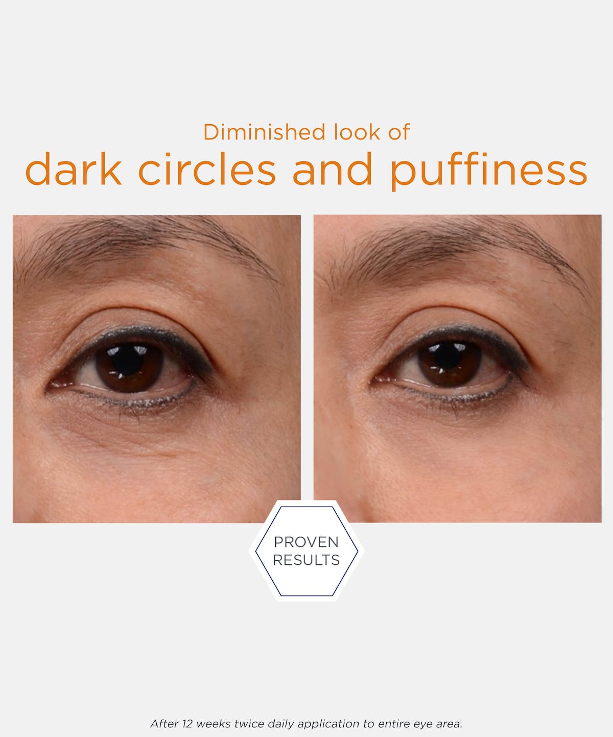 Brightening Eye Cream
