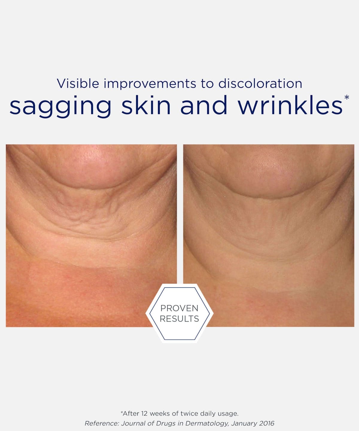 Triple Firming Neck Cream