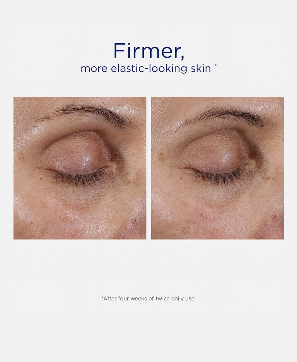 Intensive Eye Therapy